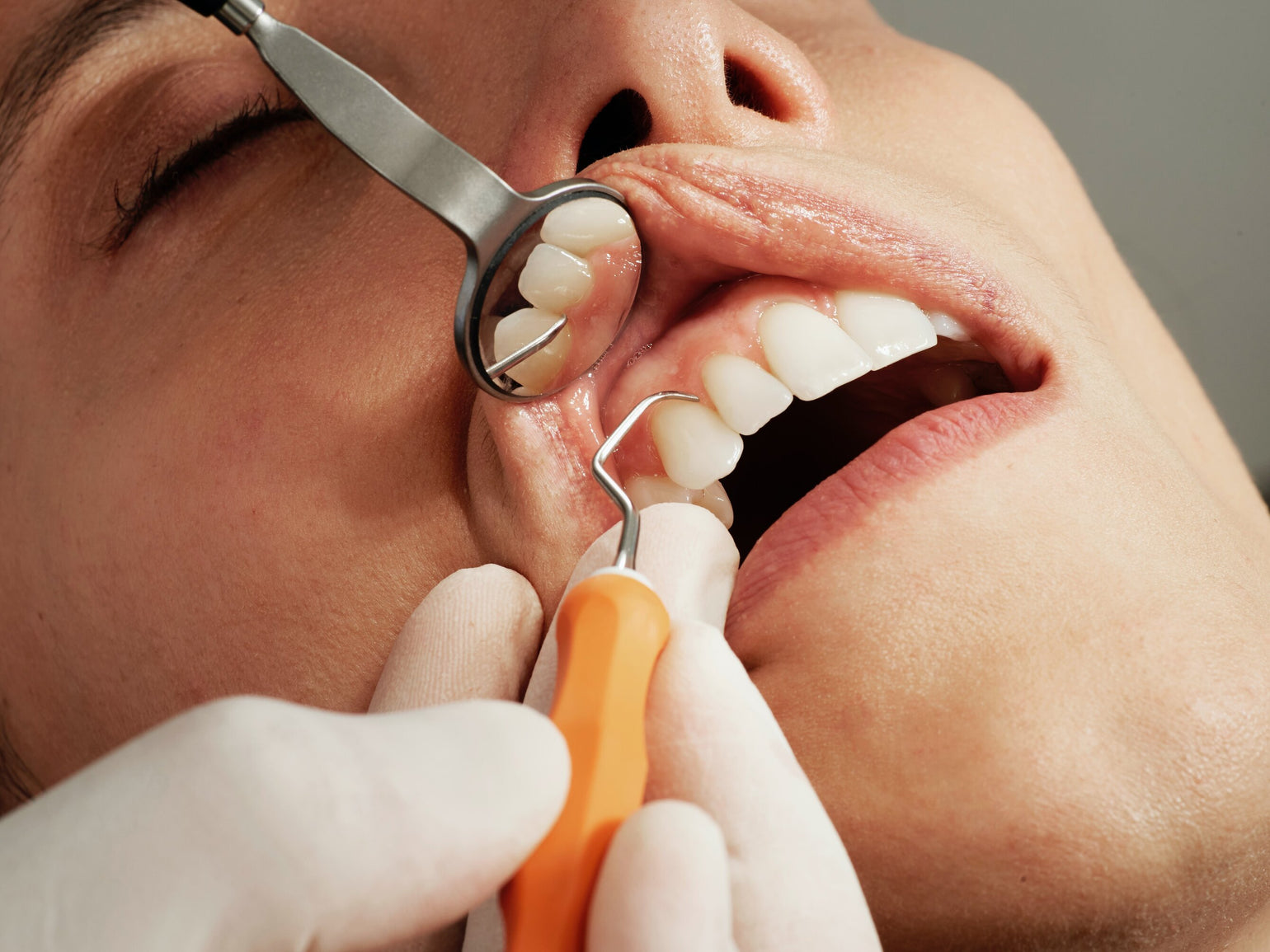 Why Do My Gums Bleed?